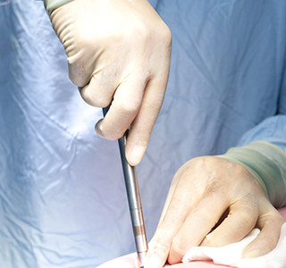 Hernia care